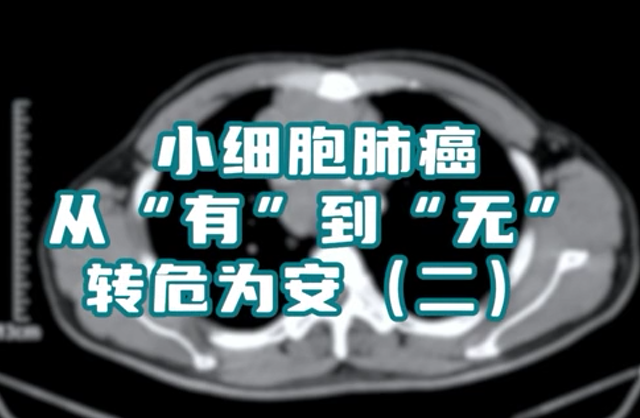 小細(xì)胞肺癌患者，縱隔淋巴結(jié)腫大，情況危急。通過(guò)介入綜合治療，病灶已基本消失